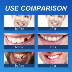 Clinclii™ --Advanced Customized Full Denture Set🦷