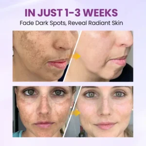 Clinclii™ Radiant Clear Blemish & Brightening Serum