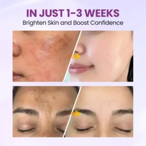 Clinclii™ Radiant Clear Blemish & Brightening Serum