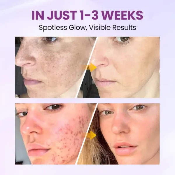 Clinclii™ Radiant Clear Blemish & Brightening Serum