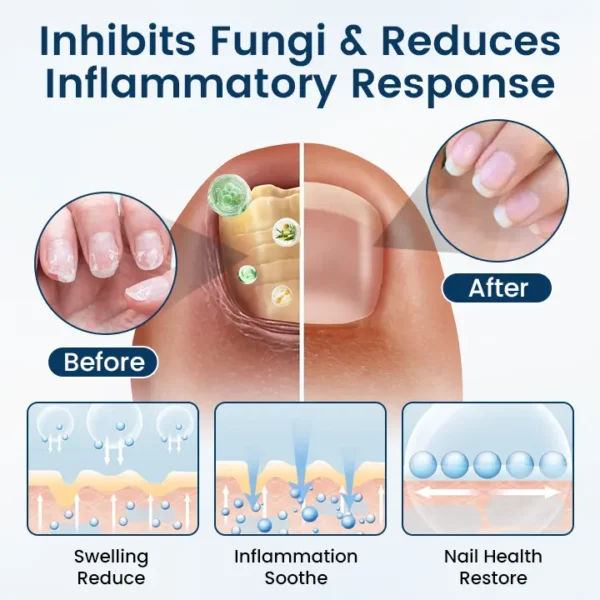 Clinclii™ OnyxiGuard Fungal Repair Herbal Spray