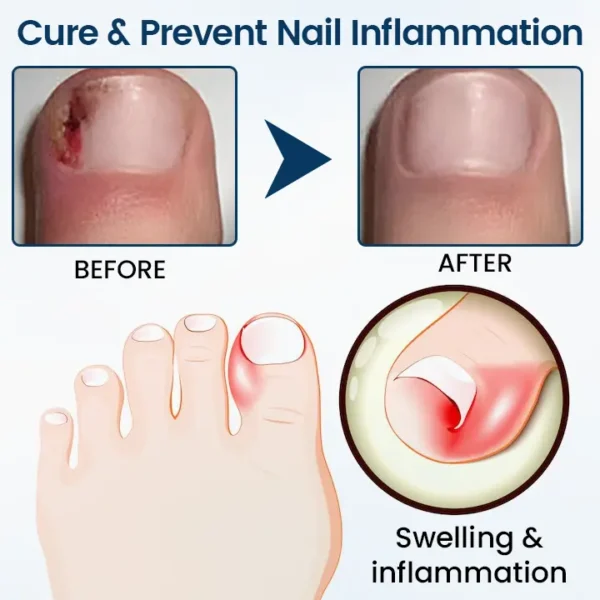Clinclii™ OnyxiGuard Fungal Repair Herbal Spray